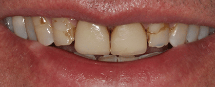 Dahlgren Dental